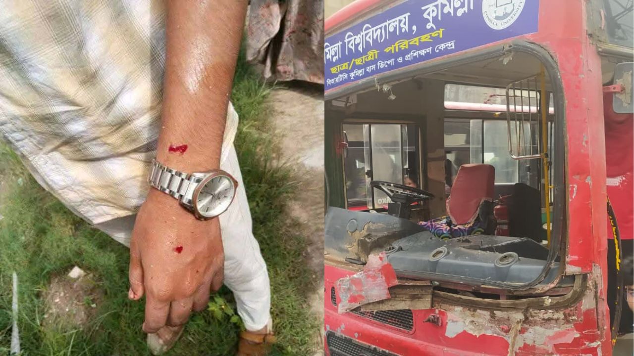 ইউটার্ন নিতে গিয়ে ট্রাকের সঙ্গে কুবির শিক্ষার্থী বহনকারী বাসের ধাক্কা, আহত একাধিক